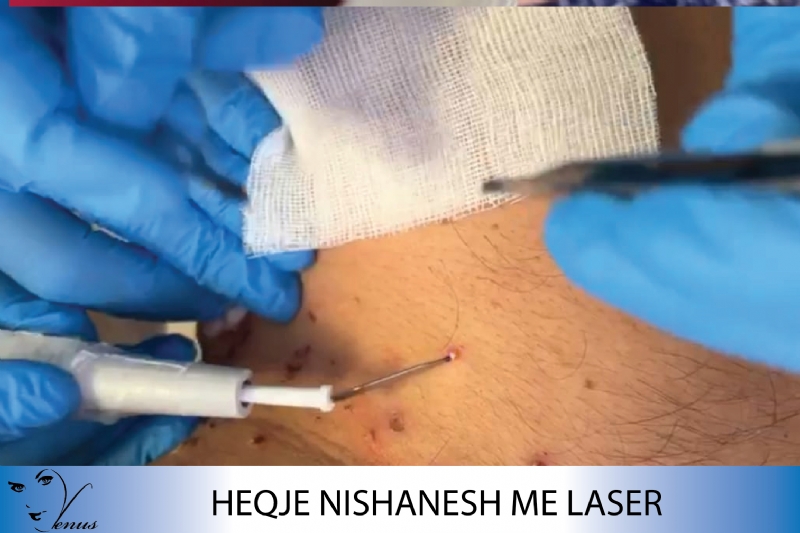 Ekzaminim i lekures me llampe wood, Diagnostikim nishaneve me dermatoskop, UVB narrow band për trajtimin e vitiligos, Trajtim i djersitjes, Jonoforeze per trajtimin e djerses se shtuar, trikoskopi, ekzaminimi flokut